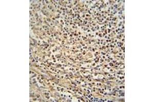 Immunohistochemistry analysis in formalin fixed and paraffin embedded human spleen tissue reacted with Gasdermin C Antibody (Center) followed by peroxidase conjugation of the secondary antibody and DAB staining.