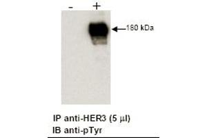 Combined immunoprecipitation and immunoblot of a human cell lysate using anti-HER3 antibody.