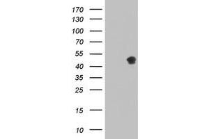 Western Blotting (WB) image for anti-serpin Peptidase Inhibitor, Clade A (Alpha-1 Antiproteinase, Antitrypsin), Member 5 (SERPINA5) antibody (ABIN1500058)