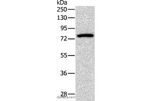 Western blot analysis of Mouse brain tissue, using PRKCG Polyclonal Antibody at dilution of 1:500 (PKC gamma anticorps)