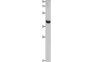 Western Blotting (WB) image for anti-Matrix Metallopeptidase 28 (MMP28) antibody (ABIN2421863)