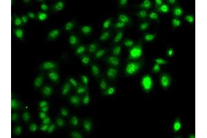 Immunofluorescence analysis of U20S cell using CBFA2T2 antibody. (CBFA2T2 anticorps)