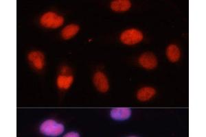 Immunofluorescence analysis of U-2 OS cells using MCM5 Polyclonal Antibody at dilution of 1:100.