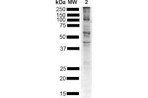 Western Blot analysis of Mouse Brain showing detection of Alpha Synuclein pSer129 protein using Rabbit Anti-Alpha Synuclein pSer129 Monoclonal Antibody, Clone J18 (ABIN6932881).