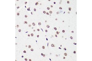 Immunohistochemistry of paraffin-embedded rat brain using H4K20me2 antibody.