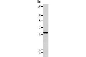 Western blot analysis of Human kidney tissue using ZNF248 Polyclonal Antibody at dilution of 1:200 (ZNF248 anticorps)