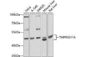 Western blot analysis of extracts of various cell lines, using TMPRSS11A antibody (ABIN6133161, ABIN6149279, ABIN6149281 and ABIN6224715) at 1:1000 dilution. (TMPRSS11A anticorps  (AA 300-421))