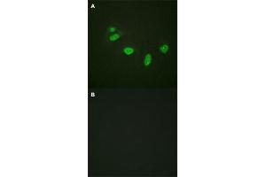 Immunofluorescence staining of methanol-fixed HeLa cells with ETS1 (phospho T38) polyclonal antibody  without blocking peptide (A) or preincubated with blocking peptide (B) at 1:100-1:200 dilution. (ETS1 anticorps  (pThr38))