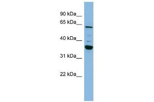 CYP3A7 antibody used at 1 ug/ml to detect target protein.
