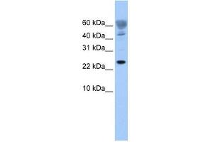 FUNDC1 antibody used at 1 ug/ml to detect target protein. (FUNDC1 anticorps  (Middle Region))