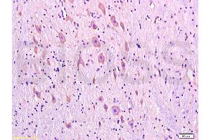 Formalin-fixed and paraffin embedded rat brain tissue labeled with Anti-DRD1 Polyclonal Antibody, Unconjugated (ABIN730843) at 1:300, followed by conjugation to the secondary antibody and DAB staining (Dopamine Receptor d1 anticorps  (AA 101-200))