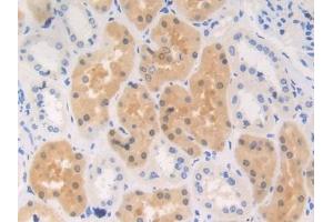 DAB staining on IHC-P; Samples: Human Kidney Tissue (RENBP anticorps  (AA 1-254))