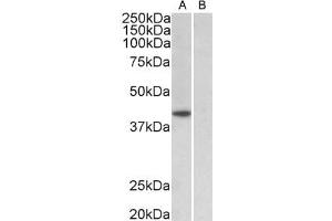 ABIN987280 (1µg/ml) staining of HeLa nuclear (A) and cytosolic (B) lysates (35µg protein in RIPA buffer). (TBP anticorps  (AA 39-50))