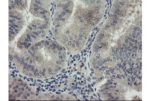 Image no. 8 for anti-rho GTPase Activating Protein 2 (ARHGAP2) antibody (ABIN1499627) (CHN1 anticorps)