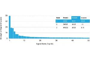 Analysis of Protein Array containing more than 19,000 full-length human proteins using CDX2 Mouse Monoclonal Antibody (CDX2/2214).