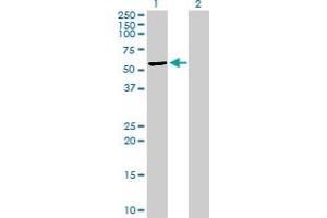 Western Blot analysis of MLKL expression in transfected 293T cell line by MLKL MaxPab polyclonal antibody. (MLKL anticorps  (AA 1-471))
