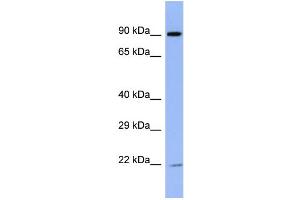 Host:  Rabbit  Target Name:  ZNF780B  Sample Type:  ACHN Whole cell lysates  Antibody Dilution:  1. (ZNF780B anticorps  (N-Term))