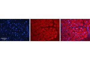 Rabbit Anti-AARS Antibody   Formalin Fixed Paraffin Embedded Tissue: Human heart Tissue Observed Staining: Cytoplasmic Primary Antibody Concentration: N/A Other Working Concentrations: 1:600 Secondary Antibody: Donkey anti-Rabbit-Cy3 Secondary Antibody Concentration: 1:200 Magnification: 20X Exposure Time: 0.