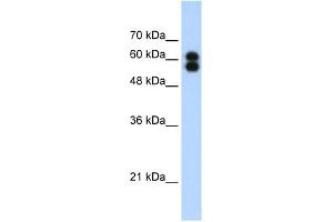 WB Suggested Anti-ALPP Antibody Titration:  1. (PLAP anticorps  (C-Term))