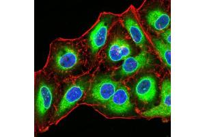 Immunocytochemistry (ICC) image for anti-Emerin (EMD) (AA 1-222) antibody (ABIN5864847) (Emerin anticorps  (AA 1-222))