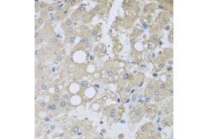 Immunohistochemistry of paraffin-embedded human liver injury using CHMP1B antibody at dilution of 1:100 (x40 lens). (CHMP1B anticorps)