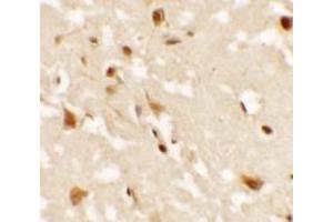 Immunohistochemistry (IHC) image for anti-Androgen-Induced 1 (AIG1) (N-Term) antibody (ABIN1031222) (AIG1 anticorps  (N-Term))