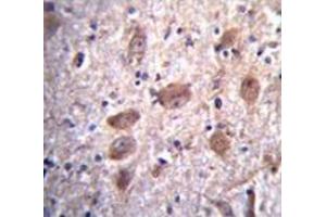 Immunohistochemistry analysis in human brain tissue (Formalin-fixed, Paraffin-embedded) using Paraplegin / SPG7  Antibody , followed by peroxidase conjugation of the secondary antibody and DAB staining. (SPG7 anticorps  (Middle Region))