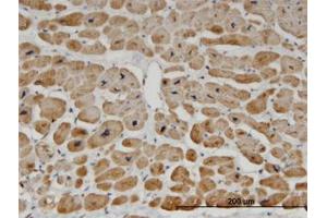Image no. 1 for anti-Zinc Finger Protein 239 (ZNF239) (AA 1-101) antibody (ABIN599472) (ZNF239 anticorps  (AA 1-101))