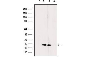 Western blot analysis of extracts from various samples, using RPL24 Antibody. (RPL24 anticorps  (Internal Region))