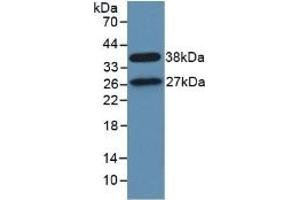 Detection of Recombinant STAM1, Human using Polyclonal Antibody to Signal Transducing Adaptor Molecule 1 (STAM1)