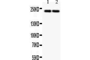 Western Blotting (WB) image for anti-Dicer 1, Ribonuclease Type III (DICER1) (AA 1-195) antibody (ABIN3043347) (DICER1 anticorps  (AA 1-195))