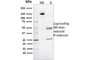 SDS-PAGE Analysis Purified 8-oxoguanine Mouse Monoclonal Antibody (CPTC-OGG1-1). (OGG1 anticorps)