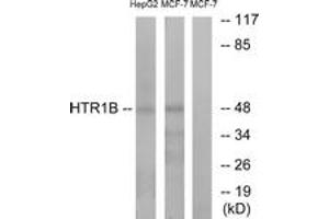 Western blot analysis of extracts from HepG2/MCF-7 cells, using HTR1B Antibody. (5HT1B Receptor anticorps  (AA 261-310))