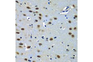 Immunohistochemistry of paraffin-embedded rat brain using PAX7 antibody at dilution of 1:100 (x40 lens). (PAX7 anticorps)