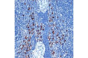 Immunohistochemistry of paraffin-embedded mouse spleen using NAIP Rabbit mAb (ABIN7268931) at dilution of 1:100 (40x lens).