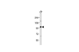 Anti-EZH2 Antibody at 1:1000 dilution + C6 whole cell lysates Lysates/proteins at 20 μg per lane.