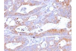 Formalin-fixed, paraffin-embedded human Colon stained with CD86 Rabbit Recombinant Monoclonal Antibody (C86/2160R). (Recombinant CD86 anticorps)