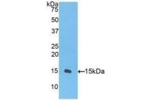 Detection of Recombinant TGFb1, Gallus using Polyclonal Antibody to Transforming Growth Factor Beta 1 (TGFb1)