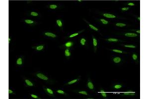 Immunofluorescence of monoclonal antibody to ISL1 on HeLa cell. (ISL1 anticorps  (AA 63-159))