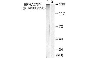 Western Blotting (WB) image for anti-Eph Receptor A2+A3 (EPHA2/3) (pTyr588), (pTyr596) antibody (ABIN1847362) (EPHA2/3 anticorps  (pTyr588, pTyr596))