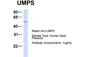 Host:  Rabbit  Target Name:  UMPS  Sample Type:  Human Adult Placenta  Antibody Dilution:  1.
