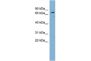 WB Suggested Anti-SLC7A2 Antibody Titration:  0. (SLC7A2 anticorps  (Middle Region))