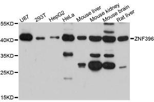 Western blot analysis of extracts of various cell lines, using ZNF396 antibody (ABIN6291098) at 1:3000 dilution. (ZNF396 anticorps)