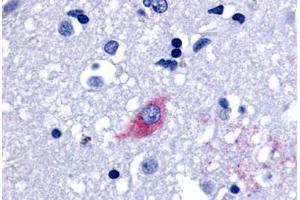 Anti-LGR4 antibody  ABIN1049003 IHC staining of human brain, neurons and glia. (LGR4 anticorps  (Cytoplasmic Domain))