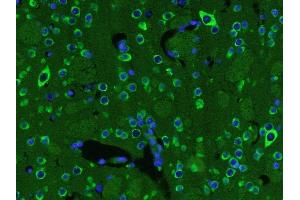 Paraformaldehyde-fixed, paraffin embedded mouse brain, Antigen retrieval by boiling in sodium citrate buffer (pH6) for 15min, Block endogenous peroxidase by 3% hydrogen peroxide for 30 minutes,  Blocking buffer (normal goat serum) at 37°C for 20min, Antibody incubation with BDNF Polyclonal Antibody (bs-4989R) at 1:400 overnight at 4°C, followed by a conjugated secondary and DAB staining. (BDNF anticorps  (AA 151-247))