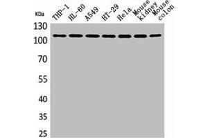 Western Blot analysis of THP-1 H460 A549 HT29 HeLa mouse kidney mouse colon cells using cPLA2 Polyclonal Antibody (PLA2G4A anticorps  (N-Term))