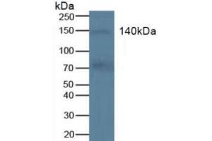 Western blot analysis of Human Blood Cells. (KIT anticorps  (AA 321-520))