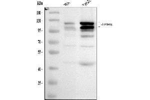 anti-erythrocyte Membrane Protein Band 4.1-Like 1 (EPB41L1) (AA 691-881) antibody