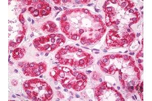 Anti-AIFM1 / AIF antibody IHC of human kidney, tubules.