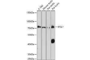 Western blot analysis of extracts of various cell lines, using MSL1 antibody (ABIN7268383) at 1:1000 dilution. (MSL1 anticorps  (AA 210-300))